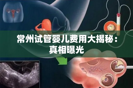 常州试管婴儿费用大揭秘:真相曝光 常州试管婴儿费用大揭秘:真相曝光