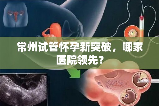 常州试管怀孕新突破，哪家医院领先？