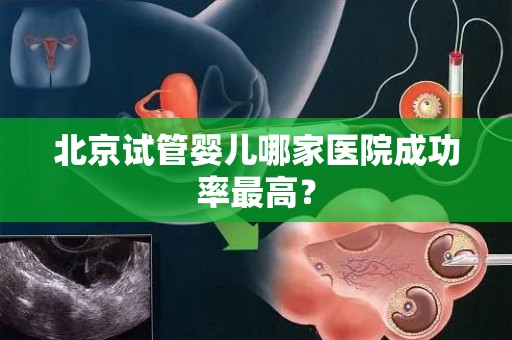 北京试管婴儿哪家医院成功率最高? 北京试管婴儿哪家医院成功率最高?