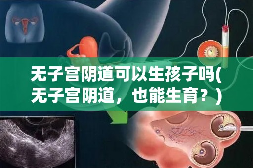 无子宫阴道可以生孩子吗(无子宫阴道，也能生育？)