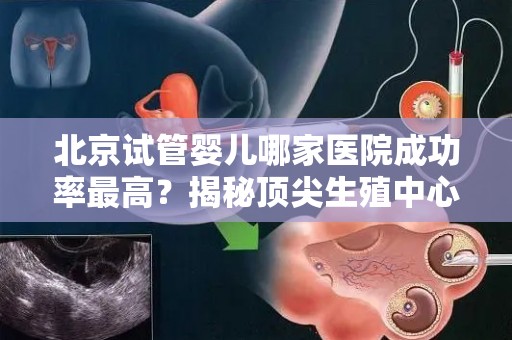 北京试管婴儿哪家医院成功率最高？揭秘顶尖生殖中心