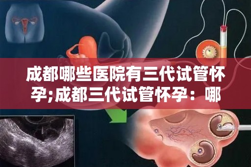 成都哪些医院有三代试管怀孕;成都三代试管怀孕：哪家医院更胜一筹？