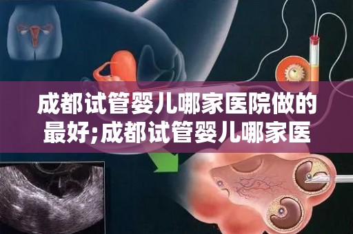 成都试管婴儿哪家医院做的最好;成都试管婴儿哪家医院技术领先？