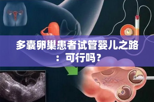 多囊卵巢患者试管婴儿之路：可行吗？