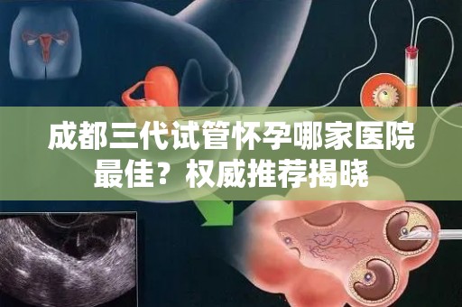 成都三代试管怀孕哪家医院最佳？权威推荐揭晓
