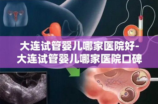大连试管婴儿哪家医院好-大连试管婴儿哪家医院口碑最佳？