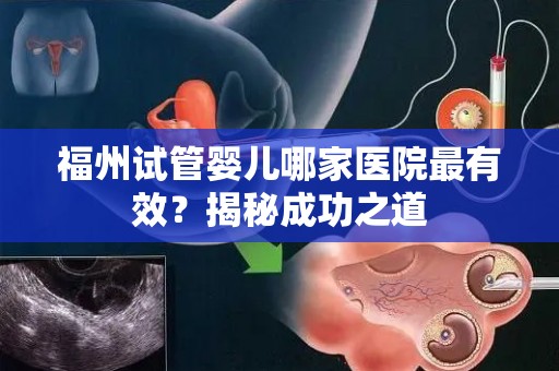 福州试管婴儿哪家医院最有效？揭秘成功之道