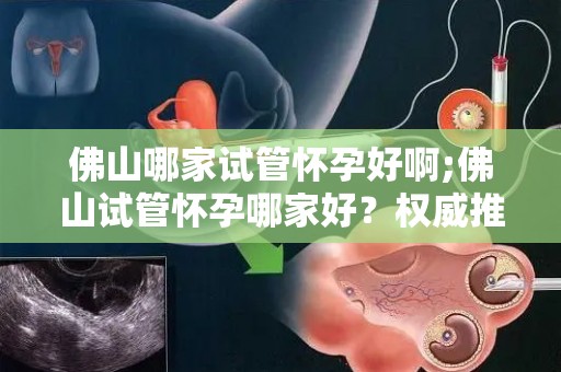 佛山哪家试管怀孕好啊;佛山试管怀孕哪家好？权威推荐