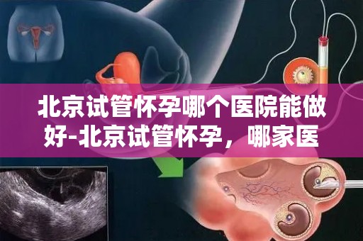 北京试管怀孕哪个医院能做好-北京试管怀孕，哪家医院技术更胜一筹？