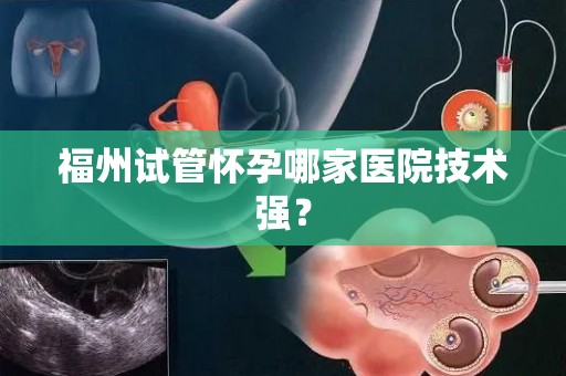 福州试管怀孕哪家医院技术强？