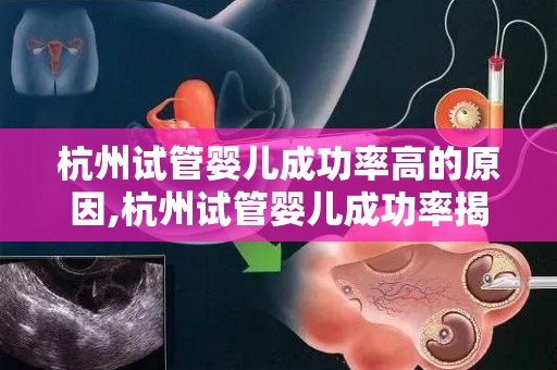 杭州试管婴儿成功率高的原因,杭州试管婴儿成功率揭秘：技术精湛，环境优越