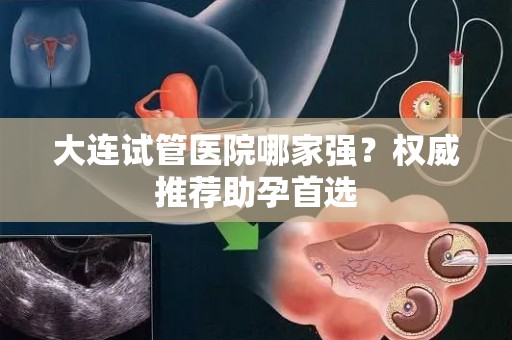 大连试管医院哪家强?权威推荐助孕首选 大连试管医院哪家强?权威推荐助孕首选