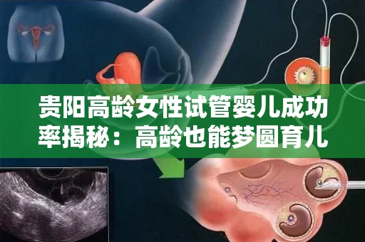 贵阳高龄女性试管婴儿成功率揭秘：高龄也能梦圆育儿