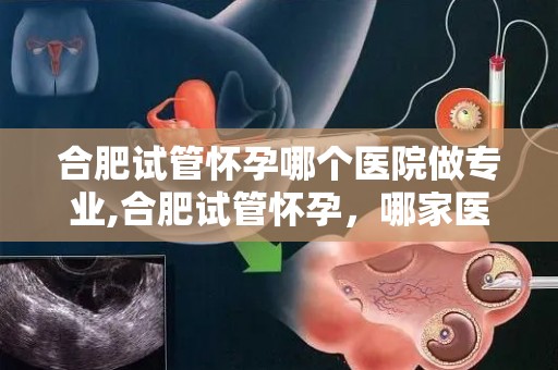 合肥试管怀孕哪个医院做专业,合肥试管怀孕，哪家医院更专业？