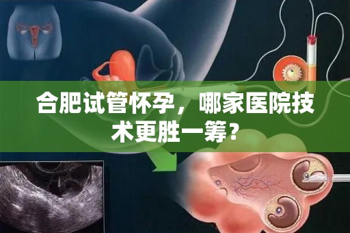 合肥试管怀孕，哪家医院技术更胜一筹？