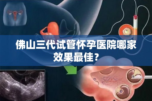 佛山三代试管怀孕医院哪家效果最佳? 佛山三代试管怀孕医院哪家效果最佳?