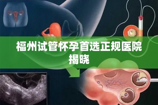 福州试管怀孕首选正规医院揭晓