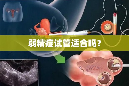 弱精症试管适合吗？