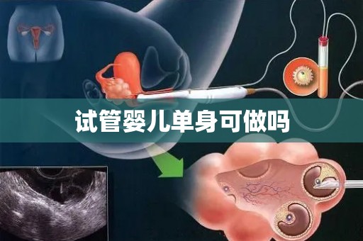 试管婴儿单身可做吗